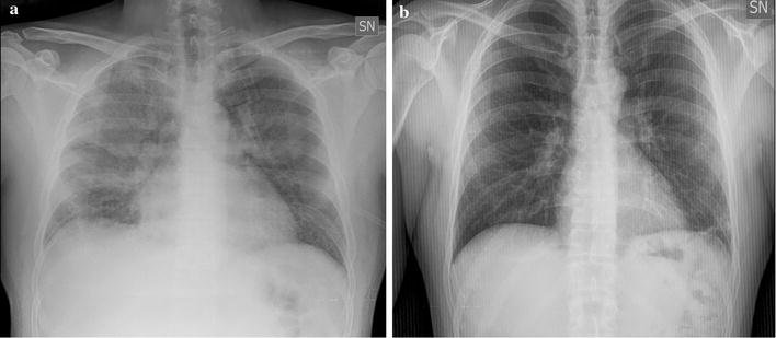 radiography and malaria treatment